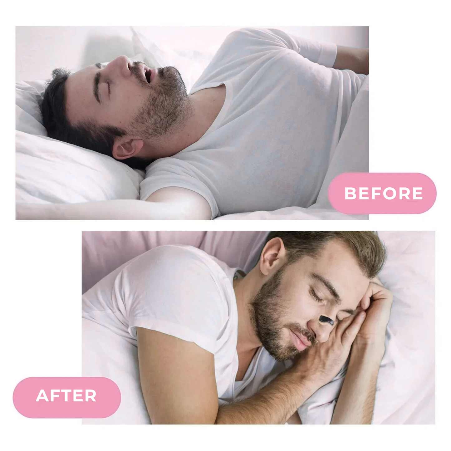 SnoreLess Pro Clip: Anti-Snoring Nose Clip, Improve Nasal Breathing and Night Sleep
