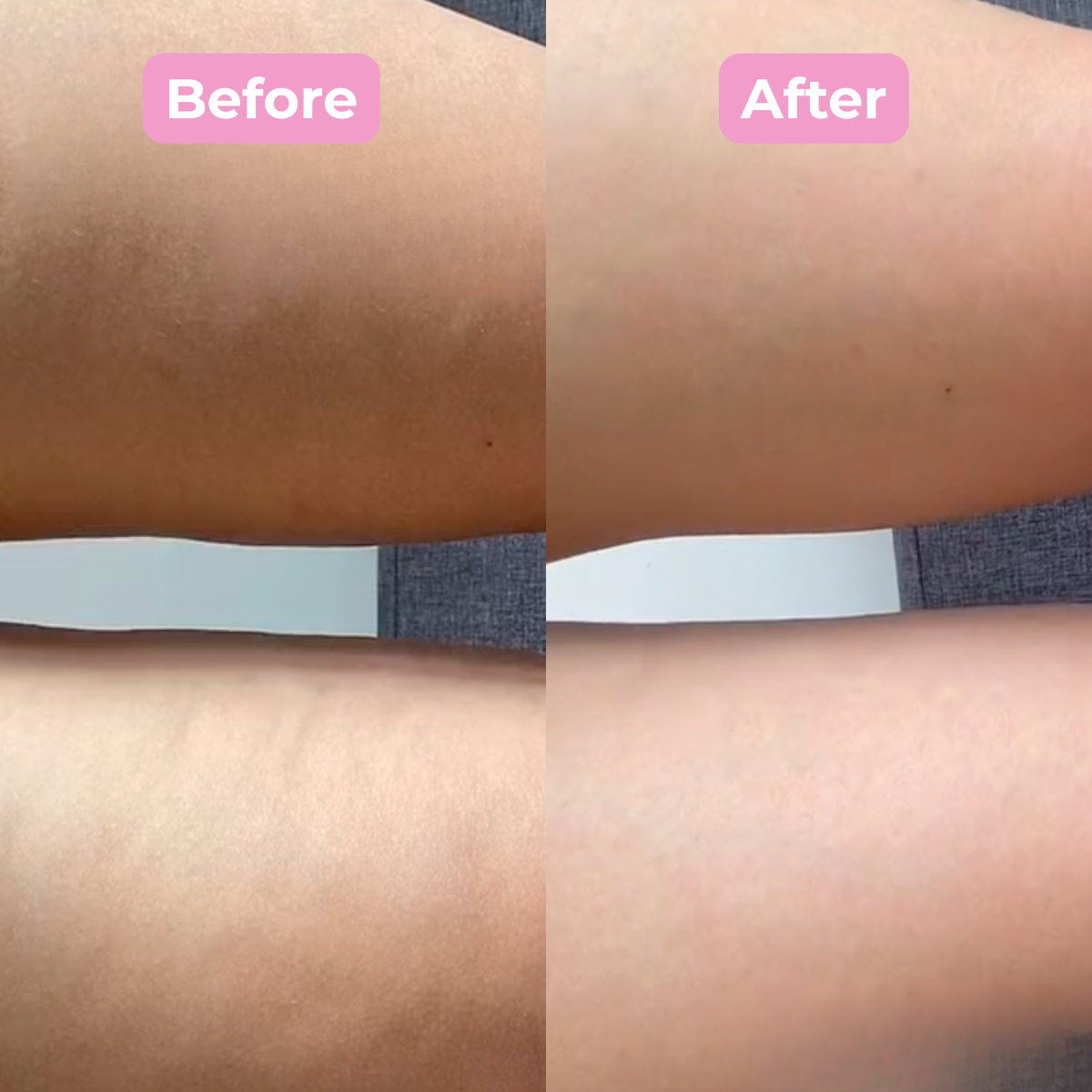 Silk Press Anti-Cellulite Brush: Smooth, Firm & Glow in Minutes a Day