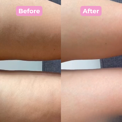 Silk Press Anti-Cellulite Brush: Smooth, Firm & Glow in Minutes a Day