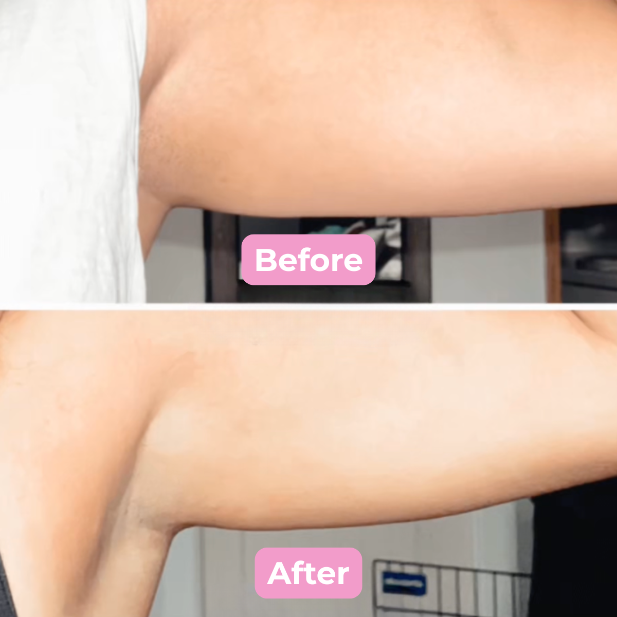 Silk Press Anti-Cellulite Brush: Smooth, Firm & Glow in Minutes a Day